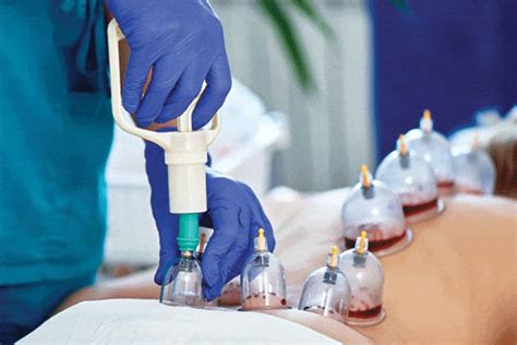 Hijama center for Health.
